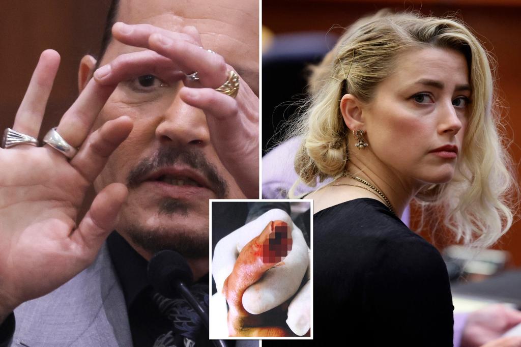 Heard's sister said the actress cut off Depp's finger: Docs