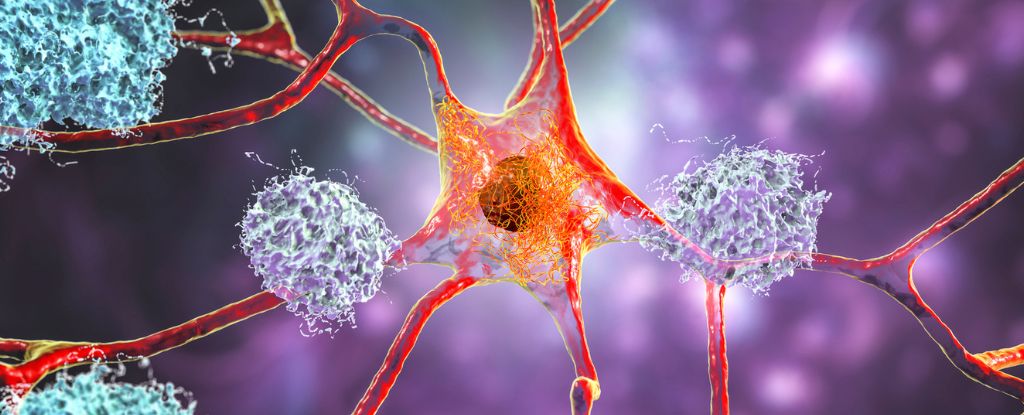 Scientists Witness For the First Time Alzheimer's 'Tipping Point' in the Laboratory: ScienceAlert
