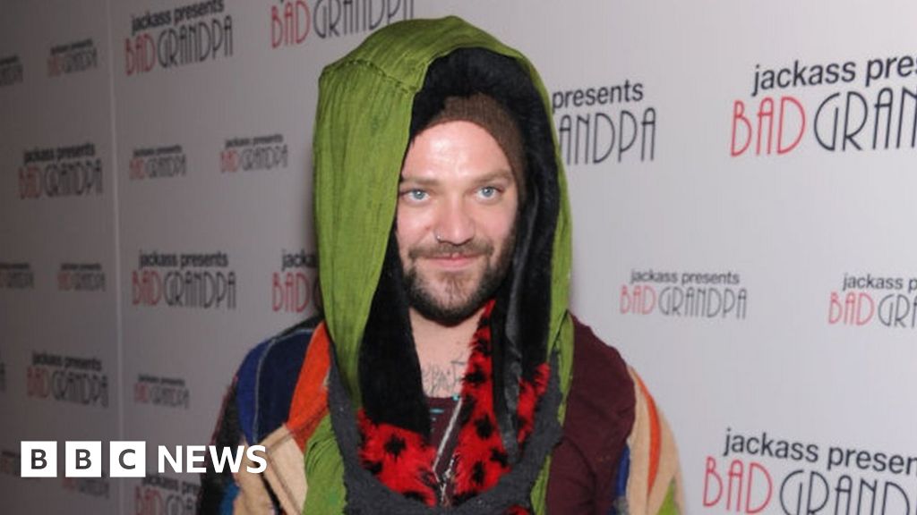Donkey star Bam Margera is turning himself into the police over an alleged assault