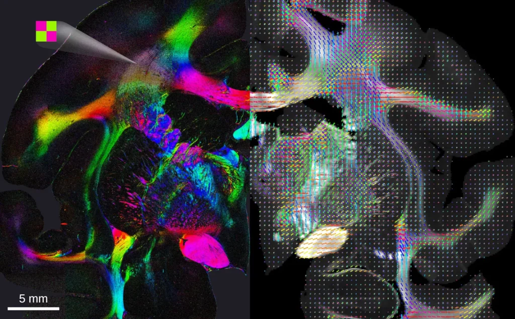 Color-Coded Brain Nerve Fiber Orientations